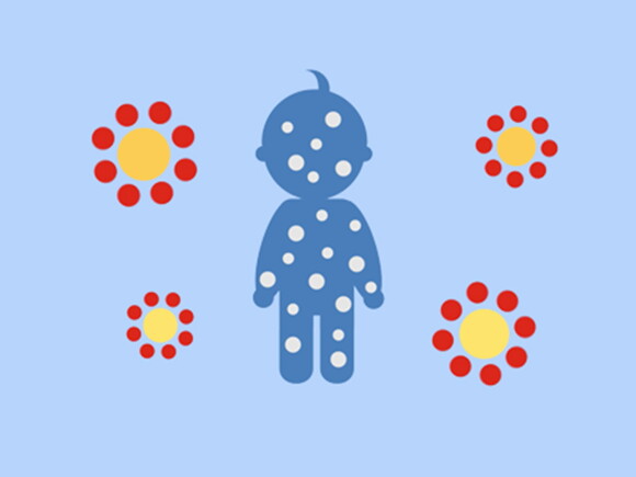 A fehérje szerepe az allergia megelőzésében csecsemőkorban